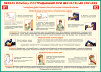 Таблица "Порядок действий при опасном кровотечении" (100х140 сантиметров, винил) - fgospostavki.ru - Тольятти