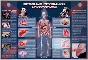 Электрифицированный стенд "Вредные привычки: алкоголизм" - fgospostavki.ru - Тольятти